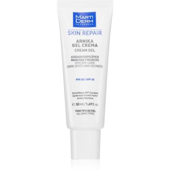 MartiDerm Skin Repair gel crema impotriva petelor intunecate SPF 30 50 ml